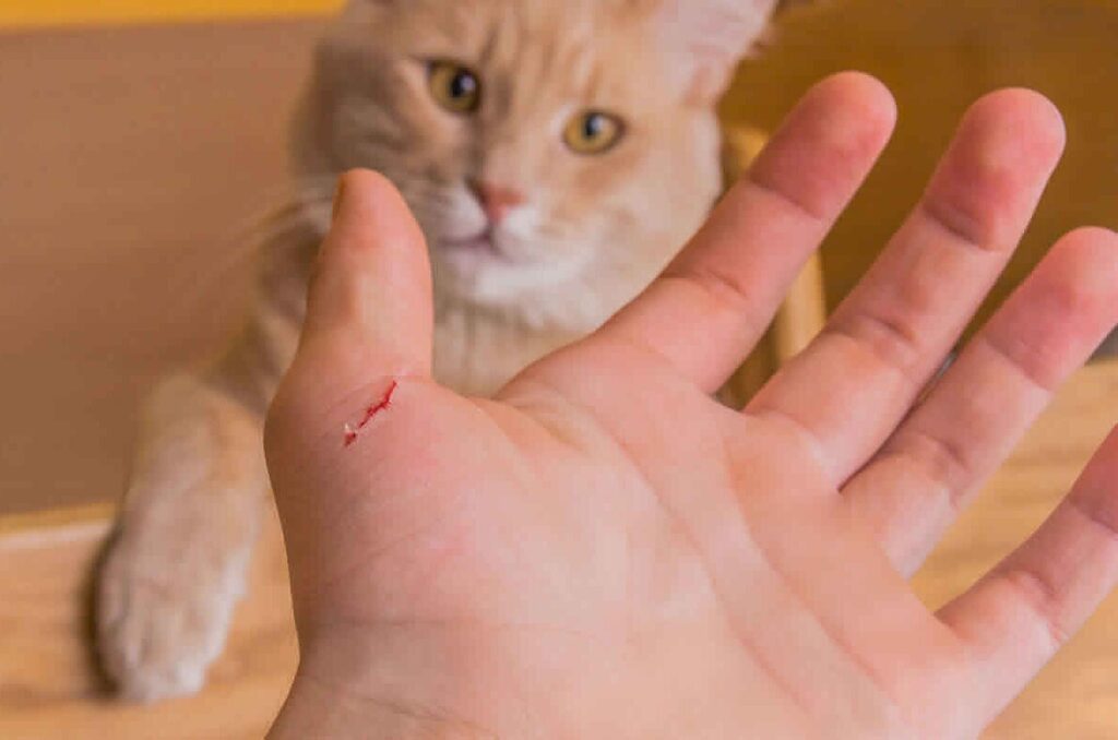 喂药过程中被猫抓伤的手